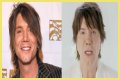 John Rzeznik Facelift | Goo Goo Dolls Frontman Plastic Surgery Before And After